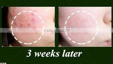 VITAMIN C Whitening Anti-Acne Treatment Face Cream 50 g