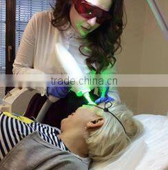 SQ-3 2016 Best portable nd yag laser q switch for eyeliner and eyebrow removal(CE)/ tatto removal laser/ tattoo erase