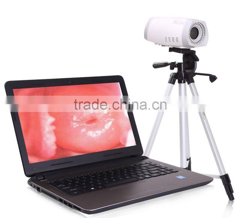 Portable Digital Electronic Colposcope in cheap price