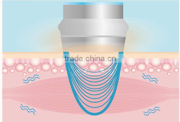 CosBeauty 2016 CE certificated Beauty Transmit Cold Hot hammer for home use, warm&cool beauty device