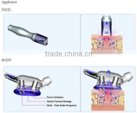 Multi-polar Radio Frequency Cavitation Vacuum For Body 2012