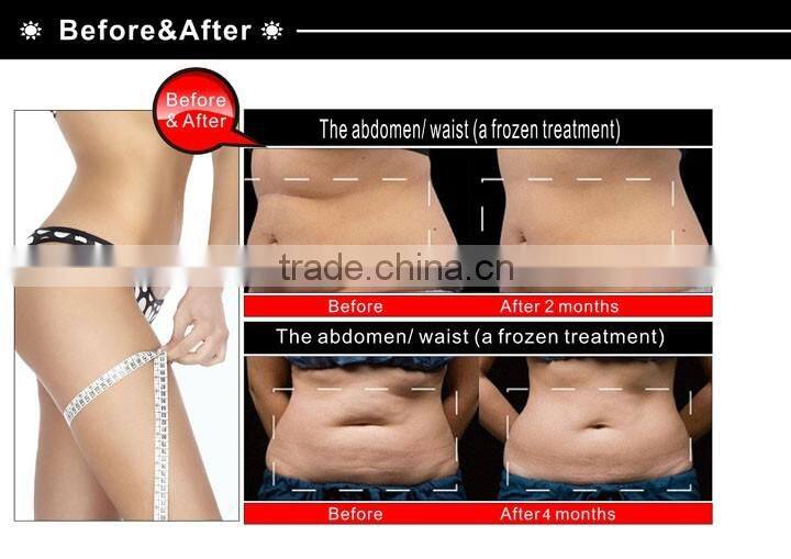 Multifunctional portable Vacuum cold laser body slimming machine