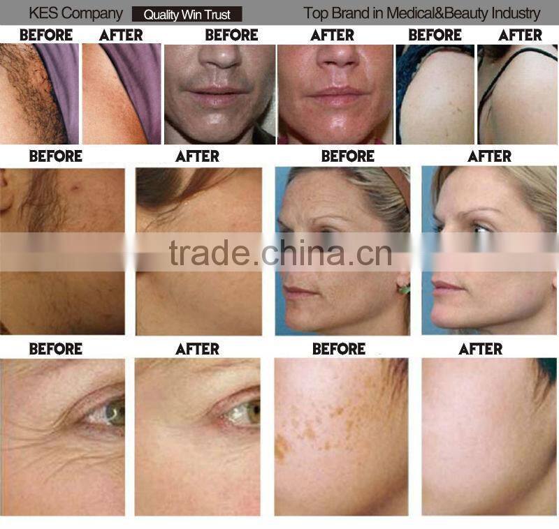 beauty equipment new arrival facial skin tightening machine