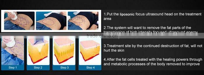 2016 best slimming technology liposunic slimming machine