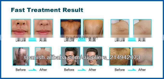 Promotion 3s hair removal epilator pulsed light (CE ISO SGS TUV)