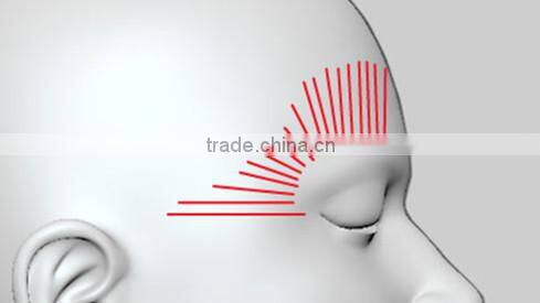 2016 hot sale hifu machine wrinkle removal/body slimming machine for home use