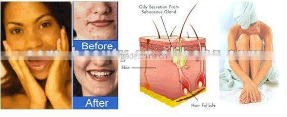 Slimming blanket-- No pain Lymphatic Drainage and slimming at home