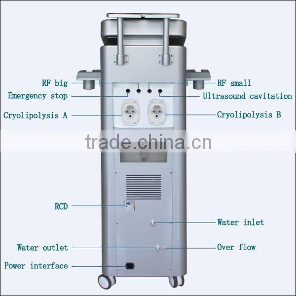 2015 Most people buy cryolipolysis machine/weight loss in short time cryolipolysis machine/lowest price cryolipolysis machine