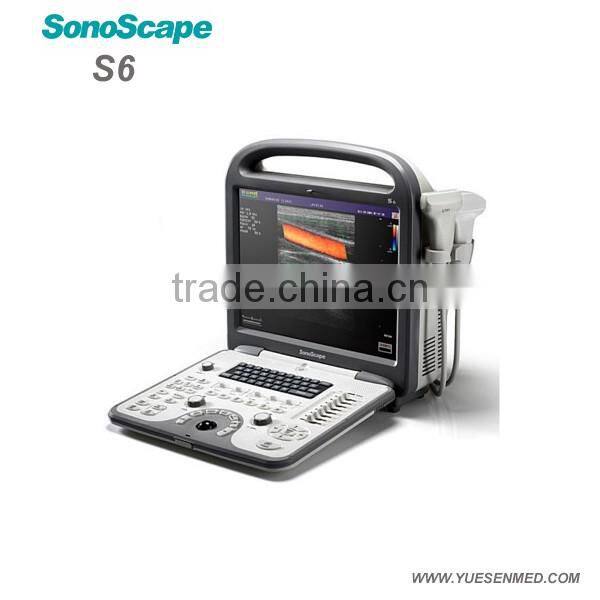 4D Sonoscape S6 Portable ultrasound machine color doppler