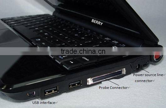 low price Portable Ultrasound machine, mini laptop Ultrasound Scanner