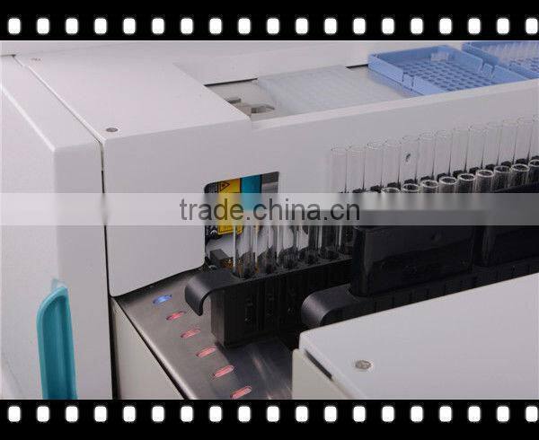minimedical clinic elisa HIV test equipment