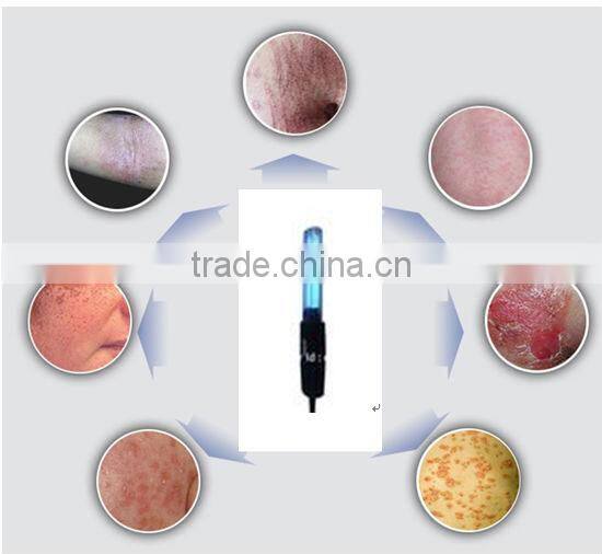 DermaPro handheld UV-B Phototherapy Lamp for skin disorder treatment