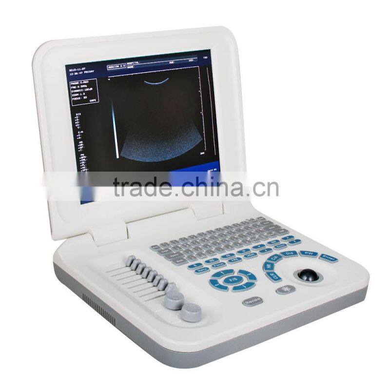 Carejoy laptop Ultrasound Machine Ultrasound Scanner with convex probe RUS-9000F2 by CE ISO approved