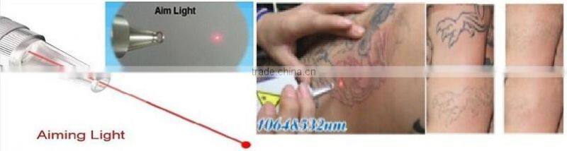 Best 1064nm 532nm 1320nm pulse q switch birthmark removal laser