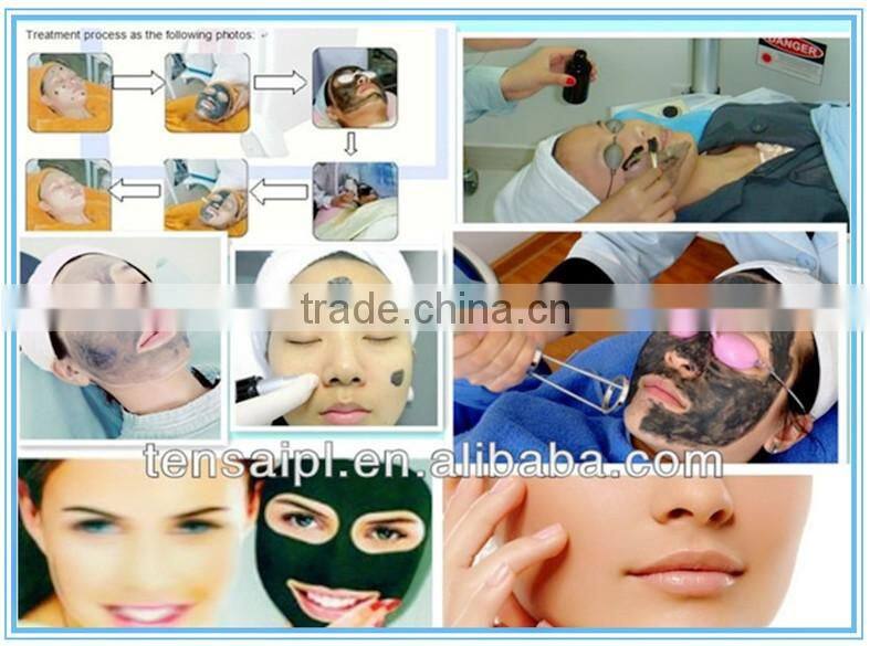 q switch nd yag laser / tattoo removal machine / laser tattoo removal