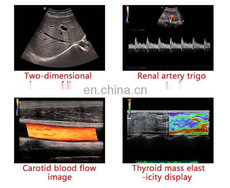 Best-selling Trolley Mindray dc-40 color doppler ultrasound machine portable Mindray ultrasound device