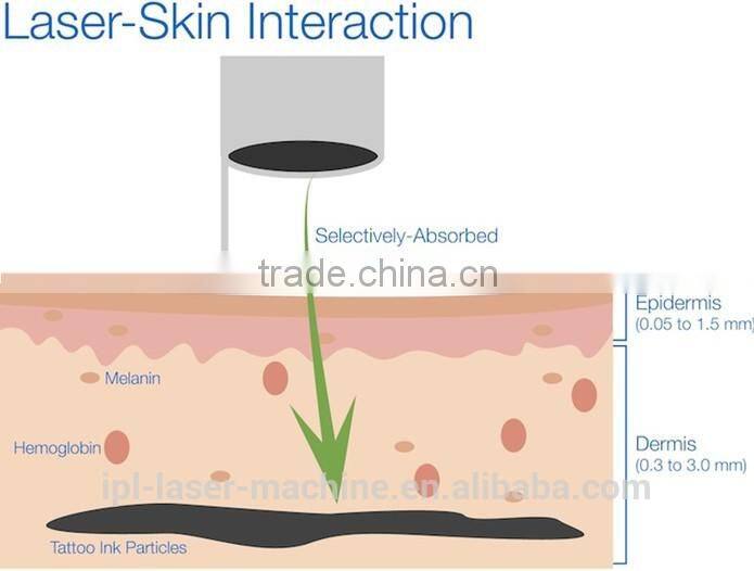 2015 new arrival first class cheap portable laser machine for tattoo removal