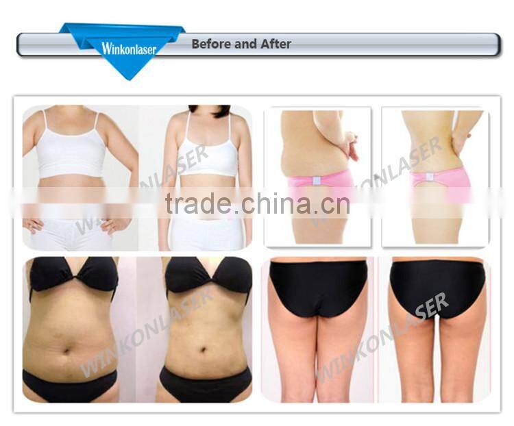 Factory price! best cellulite removal machine/ HIFU slimming beauty machine