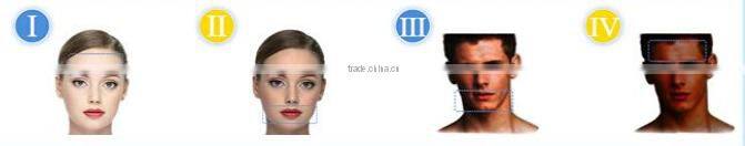 808nm Diode Laser Hair Removal Machine/Supply OEM&ODM Spare Parts