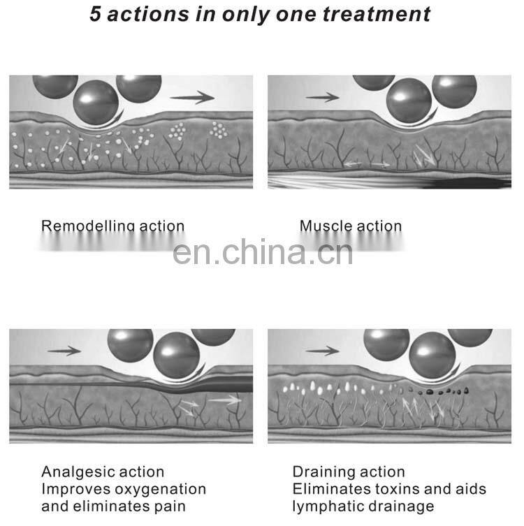 7D Vacuum Roller Massage Weight Loss instrument body Shaping Equipment body Detox Therapy