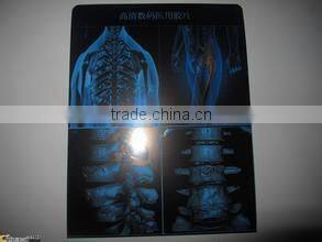 medical film thermal meter printer Medical laser paper film