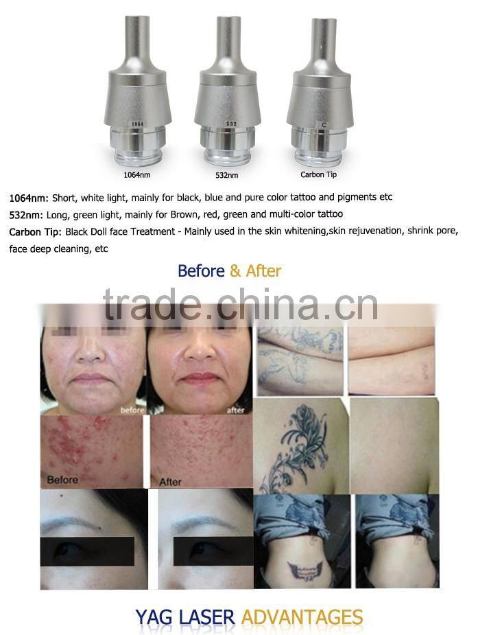 Newest! Tattoo removal feature 1500mj yag laser power supply