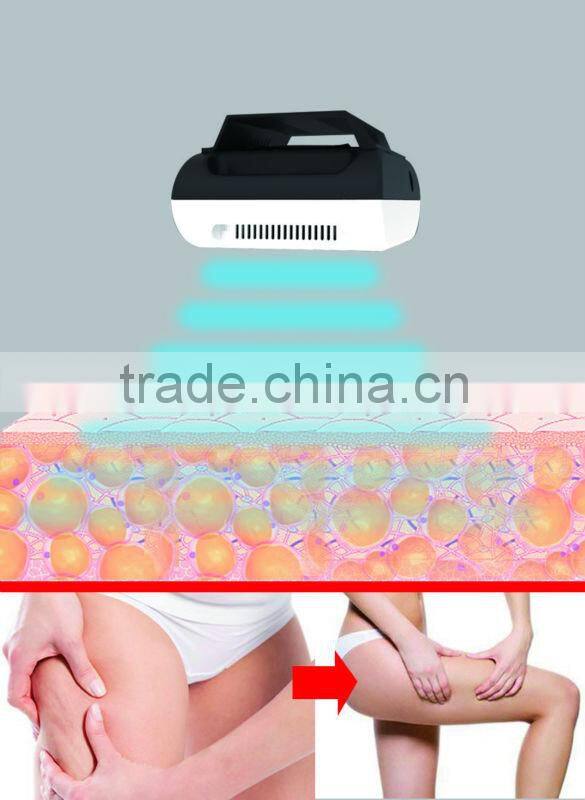 Distrbutor wanted for sale!freeze cryolipolysis freeze fat pads machine cryotherapy machine