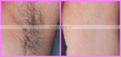 ipl hair salon beauty equipment