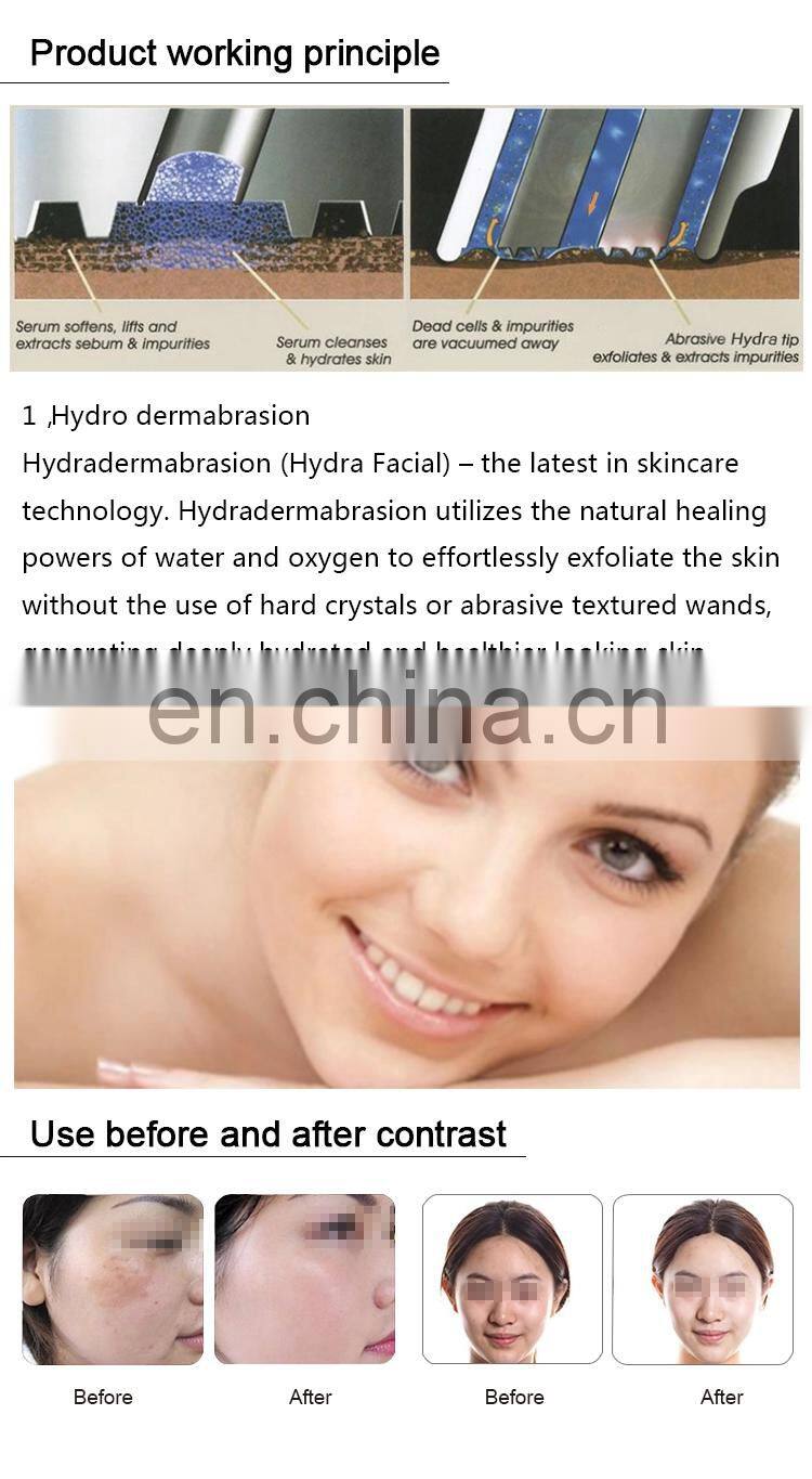 5 in 1 nano mist spray rf oxygen water spray face Beauty Machine for Spa