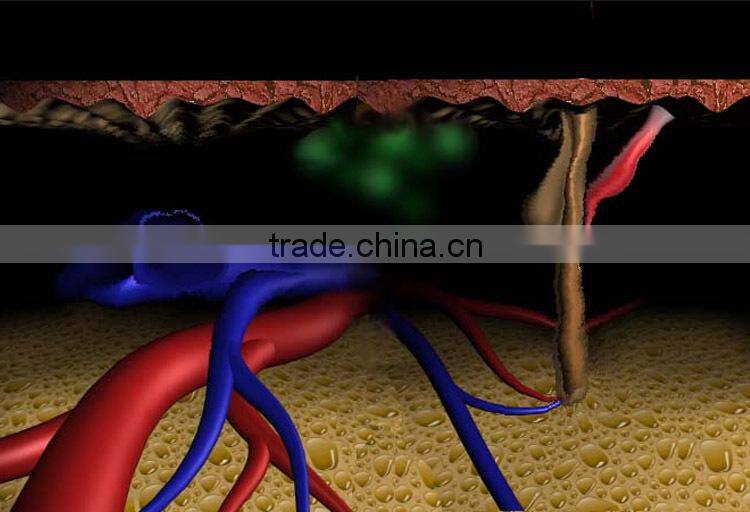 2014 diode laser soprano hair removal system 808 dilas 808 nm diode bar