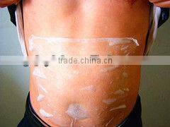 cryolipolysis machine Operation System and Portable fat freeze equipment