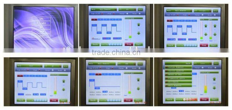 Promotion high quality E Light SHR IPL machine hair removal laser