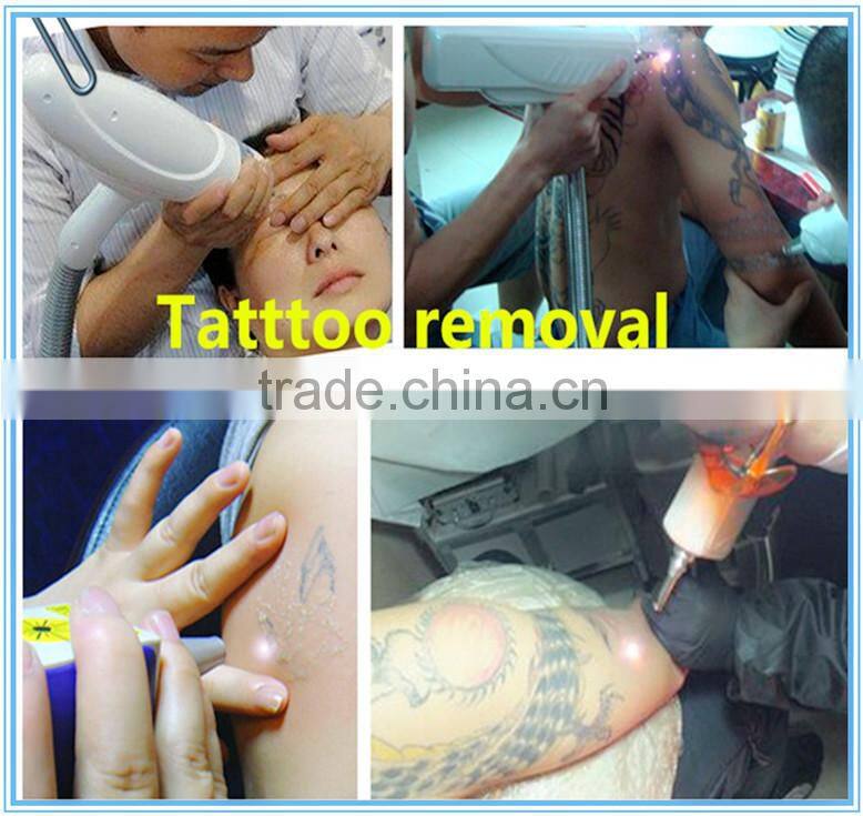 best selling products nd yag laser tattoo removal