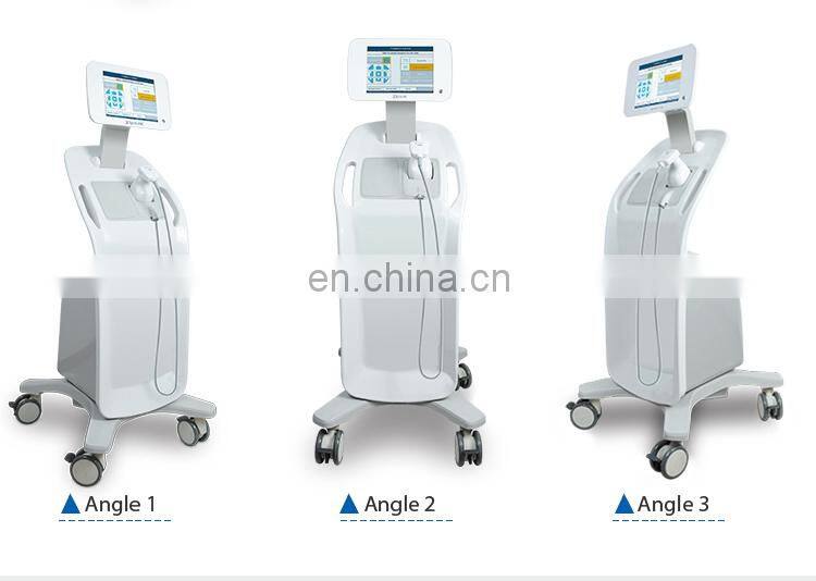 Hifu technology slimming technologoy