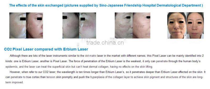 CO2 pixel laser for beauty salon/ Pixel laser /Pixel laser Co2 machine