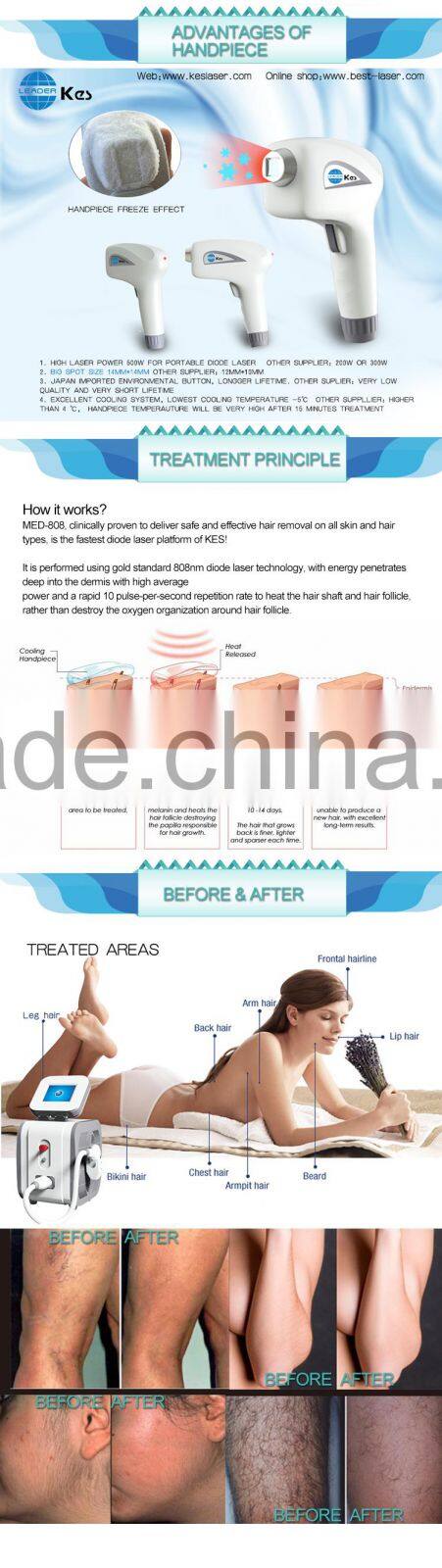 500w power supply for laser ice cooling hair removal laser portable home 808 diode laser