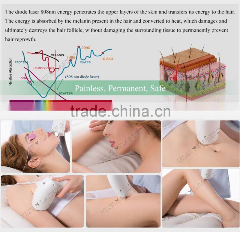 hot permanent hair removal longer life medical equipment 810nm diode laser