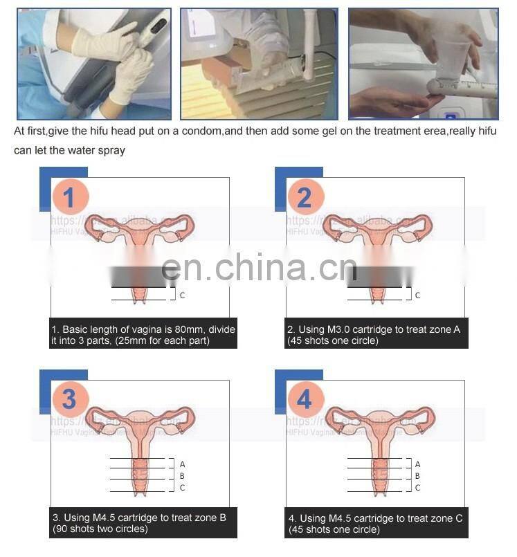 Vaginal HIFU Machine Anti-wrinkle Vaginal Tightening Machine for Beauty Spa