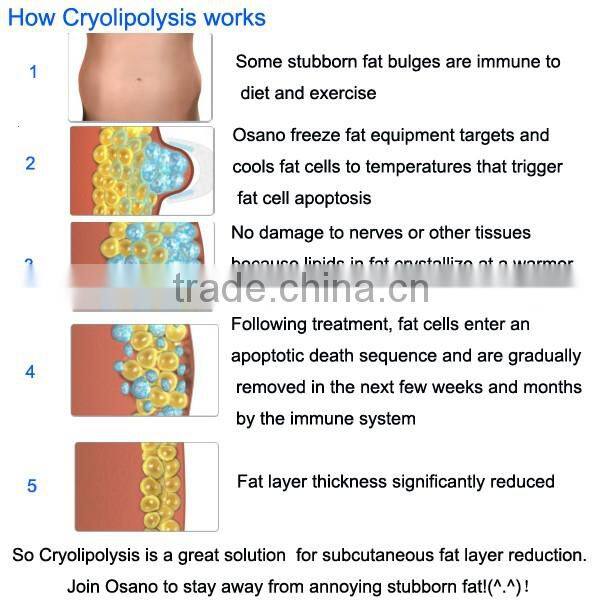 LM-S600E Cryo fat removal cryo lipolysis slimming criolipolysis fat freezing cryo lipolysis
