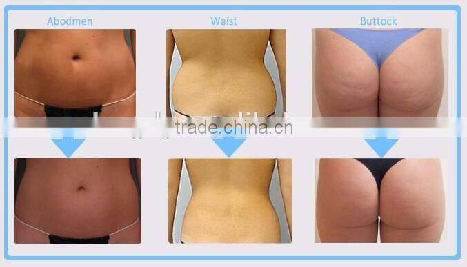 g5 weight loss electric machine /ultrasonic wave weight loss machine