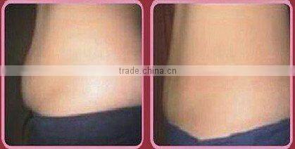 Portable Cavitation + RF Slimming Machine