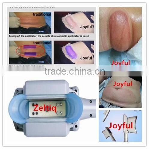 vibra fit type fat freeze slimming machine