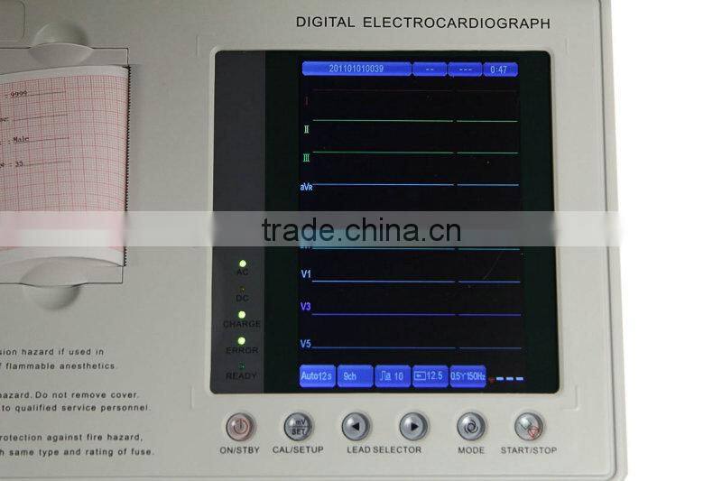 7-inch Color LCD Portable Digital 3-channel 12-lead Electrocardiograph ECG Machine EKG Machine-EKG-903A3-Shelly