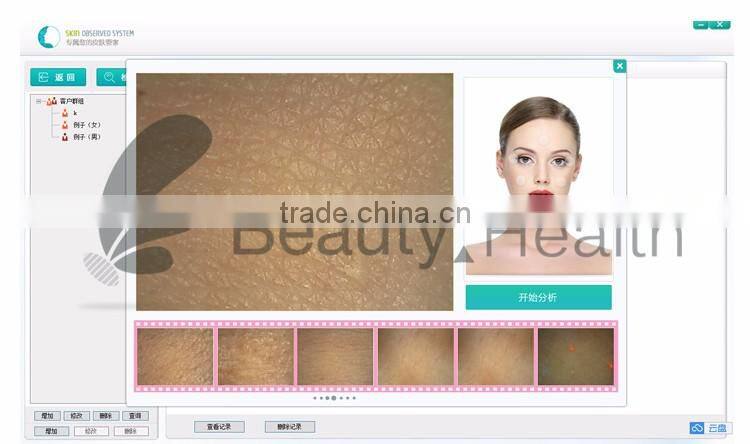 OEM new portable facial skin analyzer machine to check skin health