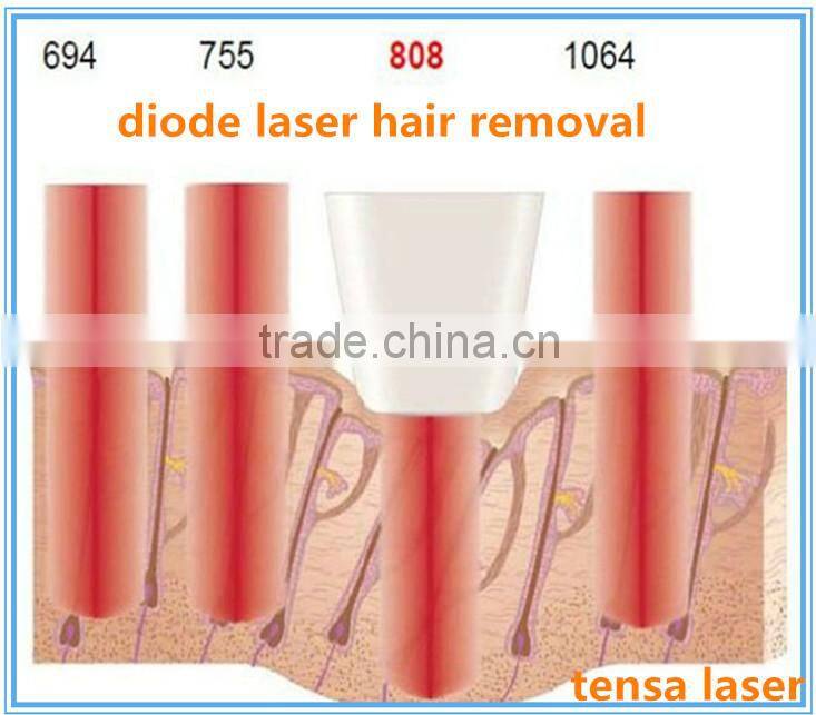 Permanent diode lazer hair removal machine