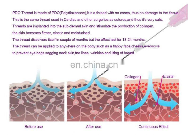 Lowest Top Selling PDO Material Lifting Face Mono Thread 29g 38mm Sharp Needle