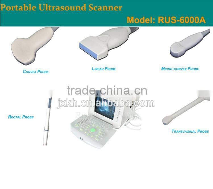 1 USB factory price OEM design 80 elements R60 ultrasound scanner for pregnancy