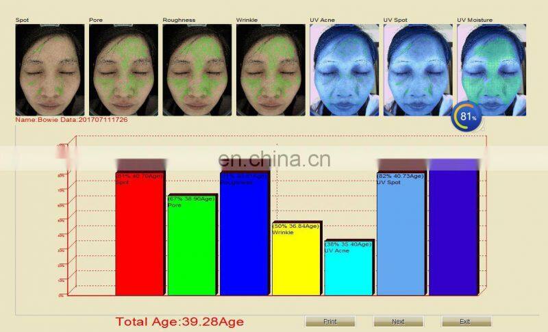 Multi Function light facial skin analysis machine for Skin Sensitiveness And Age Test
