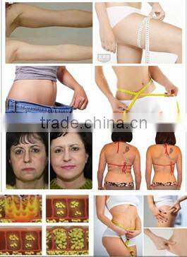 B-022 Super Shaper Weight Loss Machine/Vacuum Roller Laser+BIO+RF+Cavitation Loss Weight