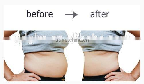 Advanced ultra body shape contouring machine on sale